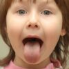 Tongue Thrust Speech Therapy 31 tongue thrust speech therapy